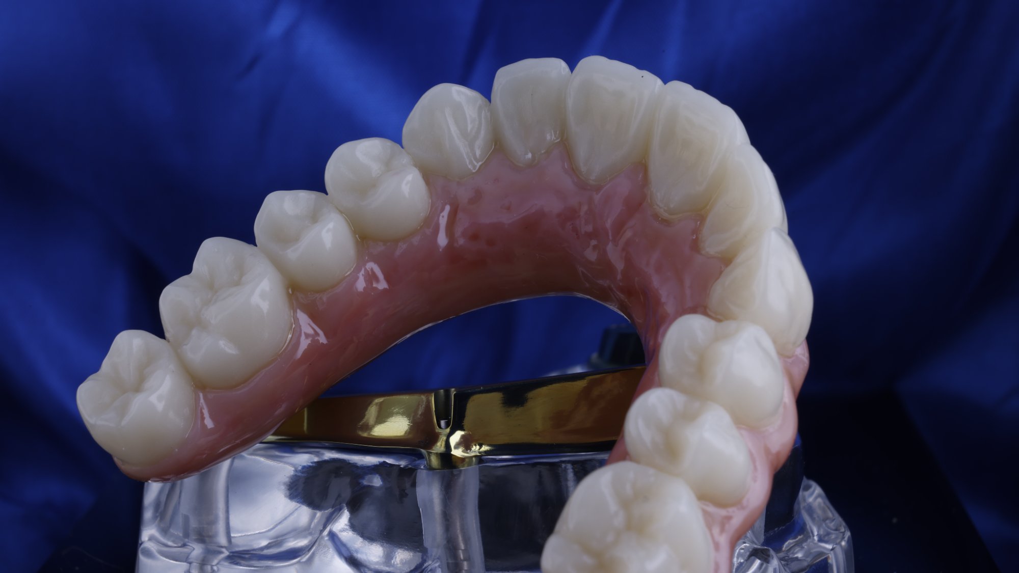 Full-arch implant restoration