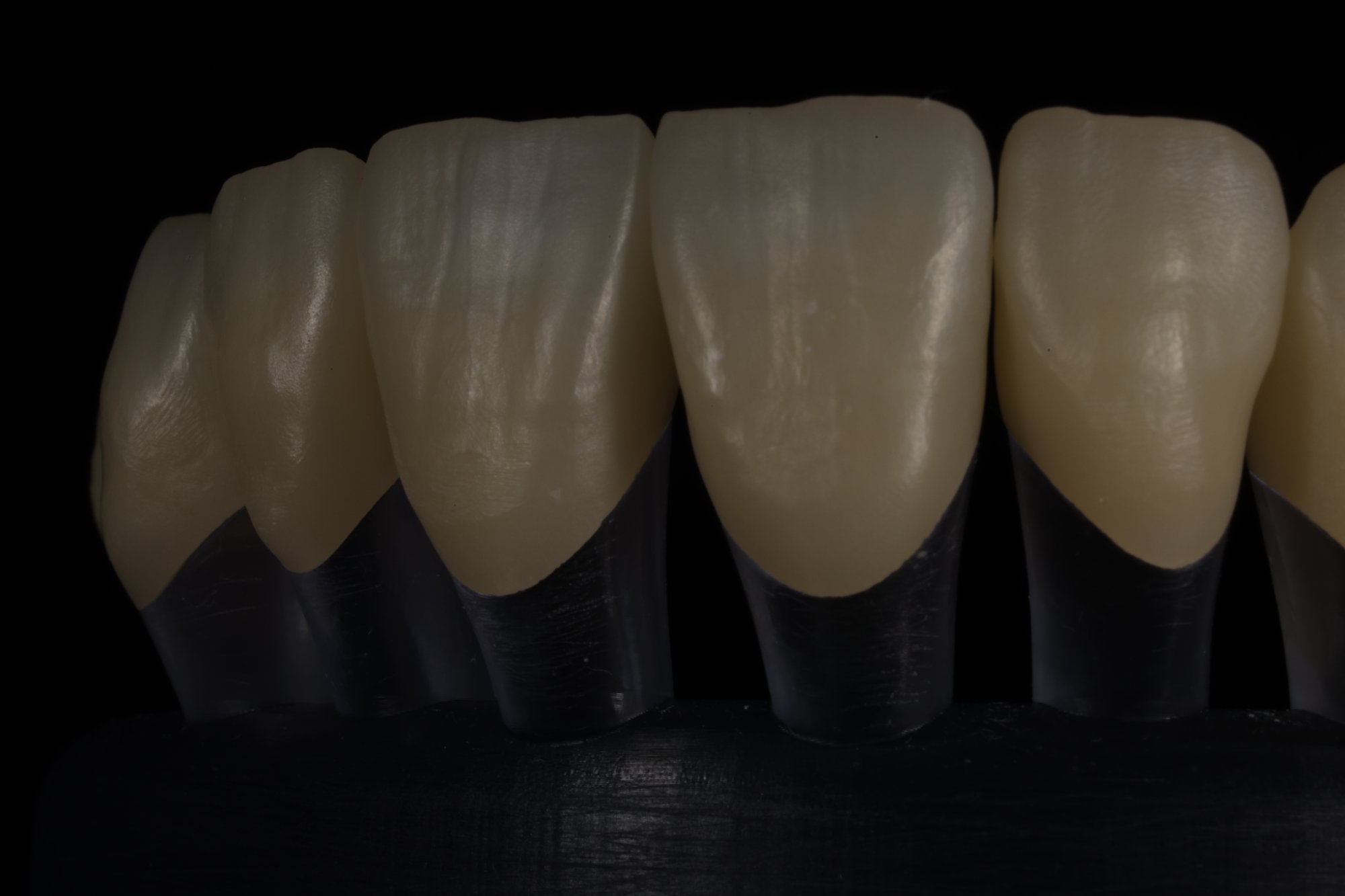 CAD/CAM crown and bridge